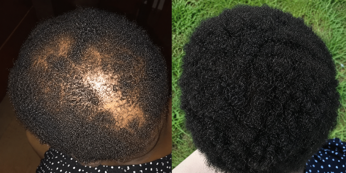 Sharon hair transformation before and after