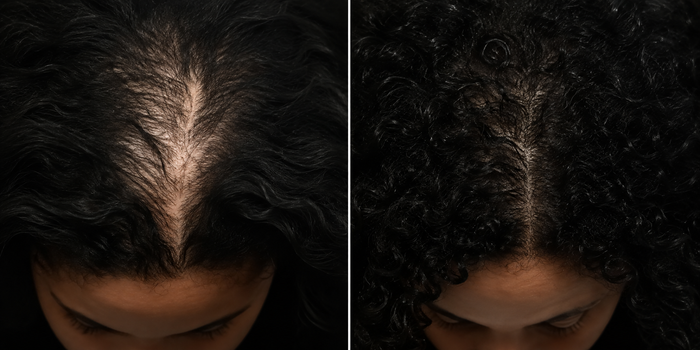 Heather hair transformation before and after