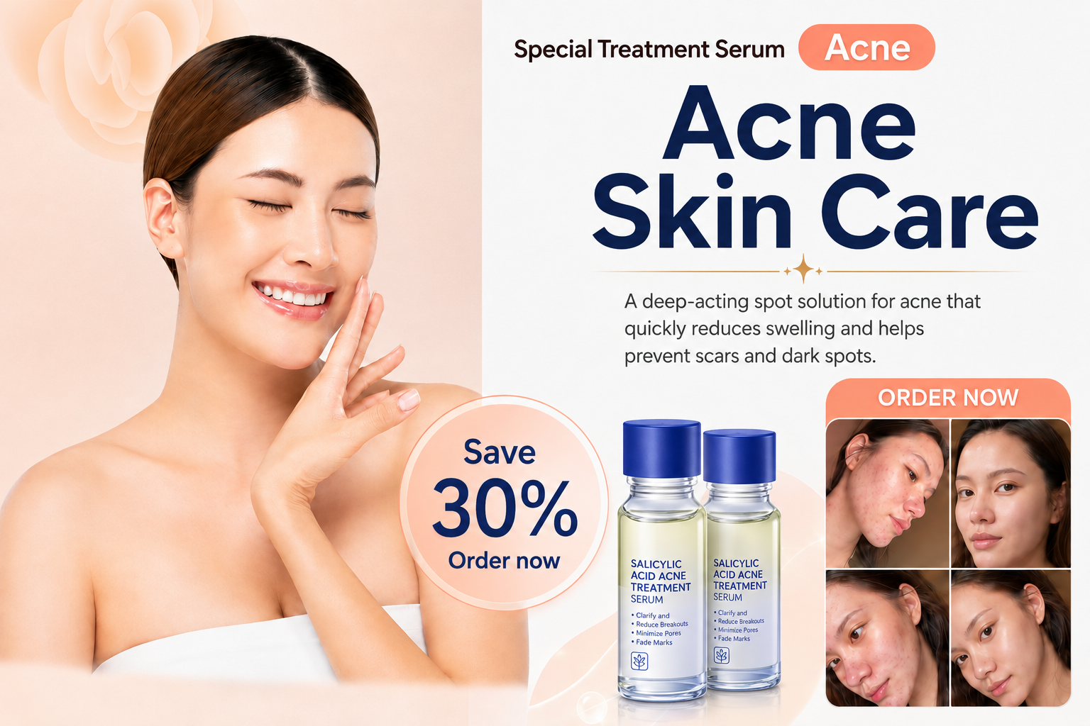 Acne Skin Care Special Treatment Serum